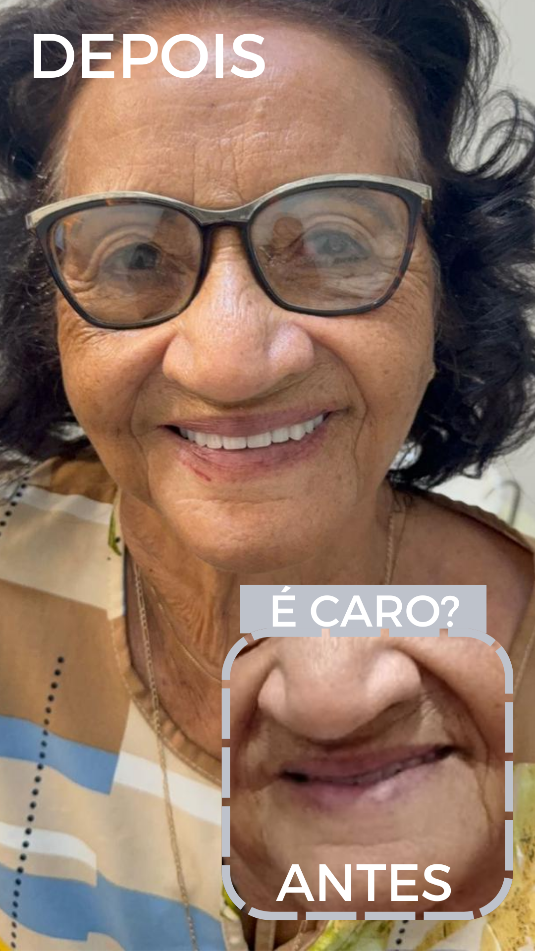 ANTES E DEPOISpng